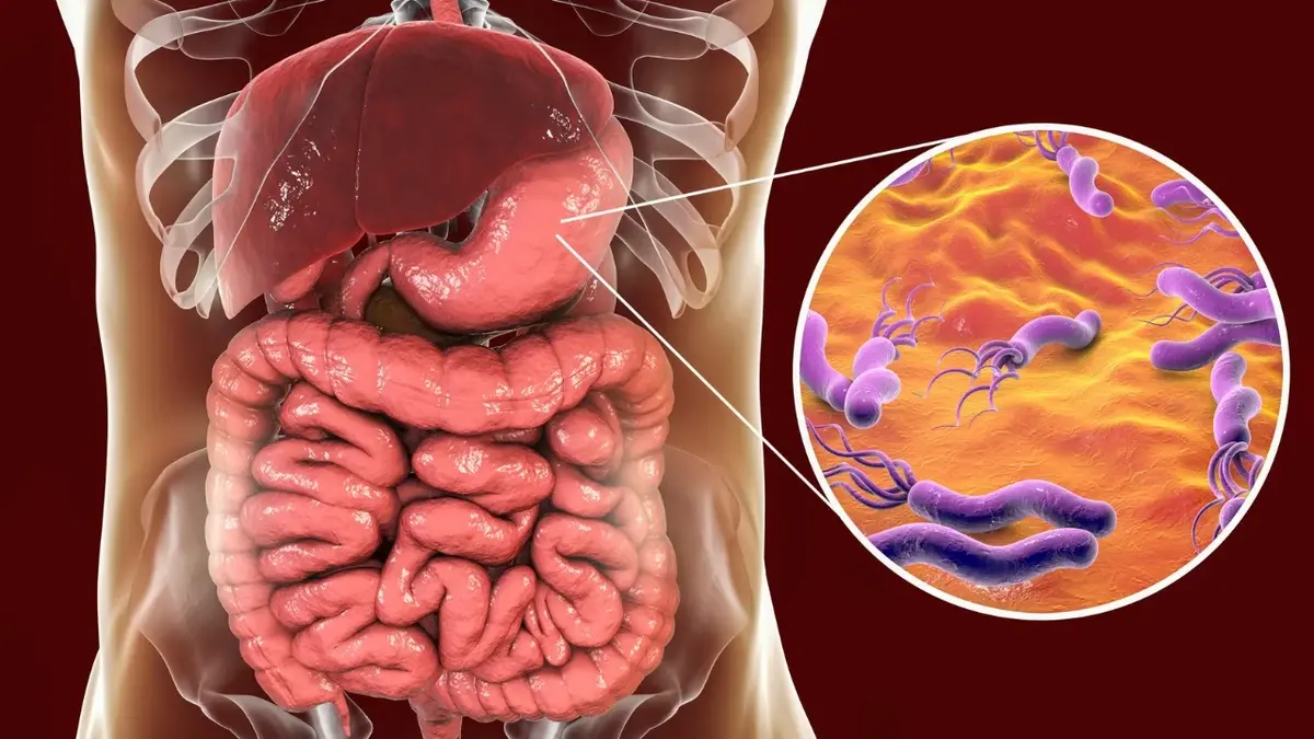 Helicobacter pylori